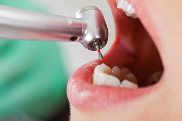 Best Broken or Chipped Tooth Repair in Lithopolis, OH